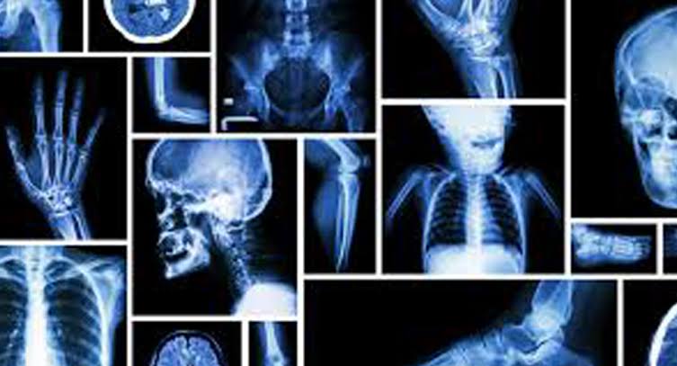 Digital X-Ray