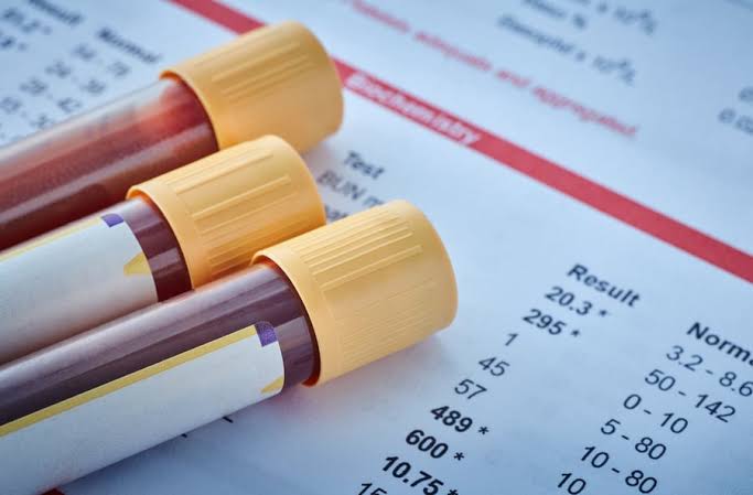 Lab Tests